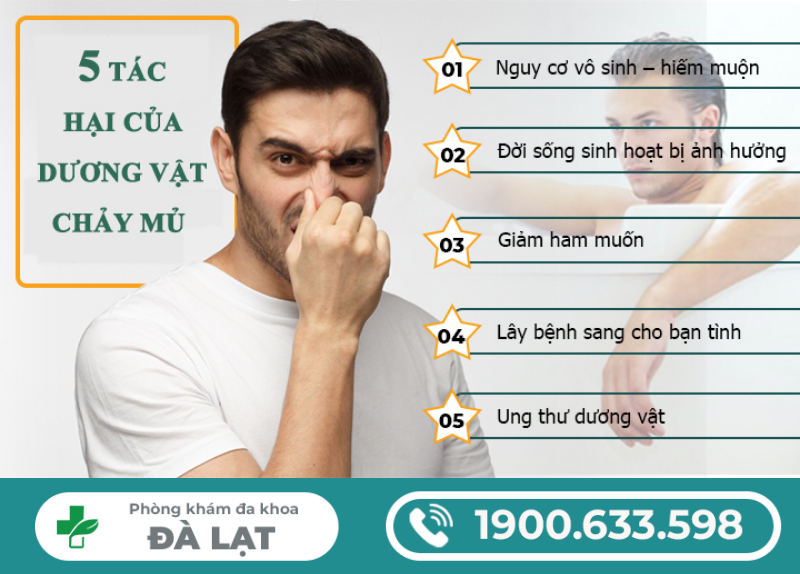 Hình ảnh minh họa